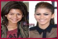 Unveiling The Secrets Of Zendaya's Nose Job: Discoveries And Insights